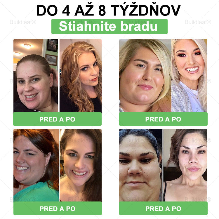 BuildLeaf® GLP-1 8-v-1 Fit & Vital Perorálny Roztok  (Len raz denne, viditeľné zmeny už za 7 dní) Pre obezitu, kardiovaskulárne ochorenia, cukrovku, spánkové apnoe, zdravie čriev, problémy s kĺbmi a ďalšie