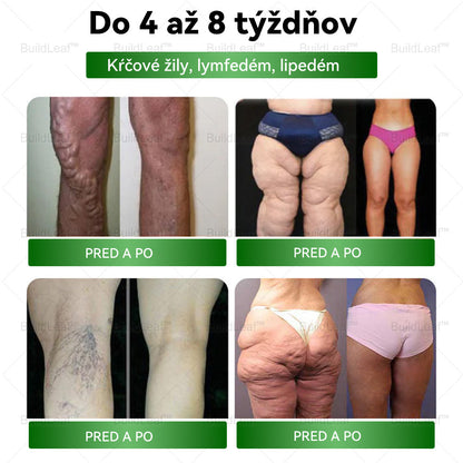 Odporúčané klinikou Mayo | Oficiálny obchod | BuildLeaf® GLP-1 Moringa Slimming & Health Boost Drops🔥 (Spaľovač tukov potravinárskej kvality – vyvinutý Spoločnosťou pre obezitu) 💪