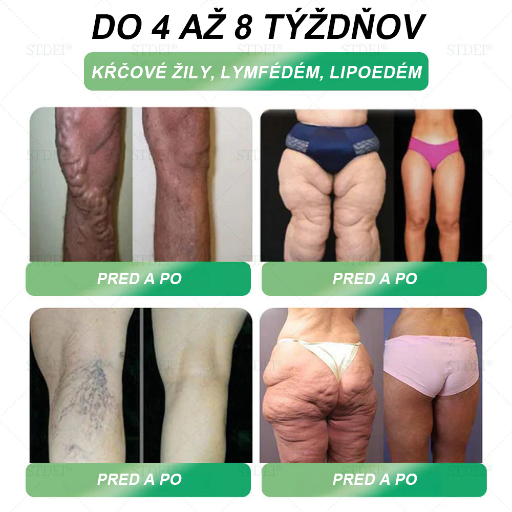 Odporúčané klinikou Mayo | Oficiálny obchod 👨‍⚕️STDEI® GLP-1 Perorálny roztok na chudnutie💥Obezita, kardiovaskulárne ochorenia, cukrovka, spánkové apnoe, problémy s kĺbmi a ďalšie