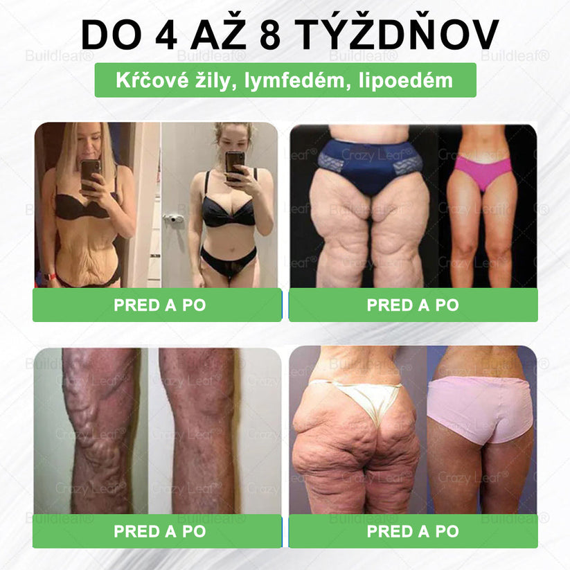 BuildLeaf® GLP-1 8-v-1 Fit & Vital Perorálny Roztok  (Len raz denne, viditeľné zmeny už za 7 dní) Pre obezitu, kardiovaskulárne ochorenia, cukrovku, spánkové apnoe, zdravie čriev, problémy s kĺbmi a ďalšie